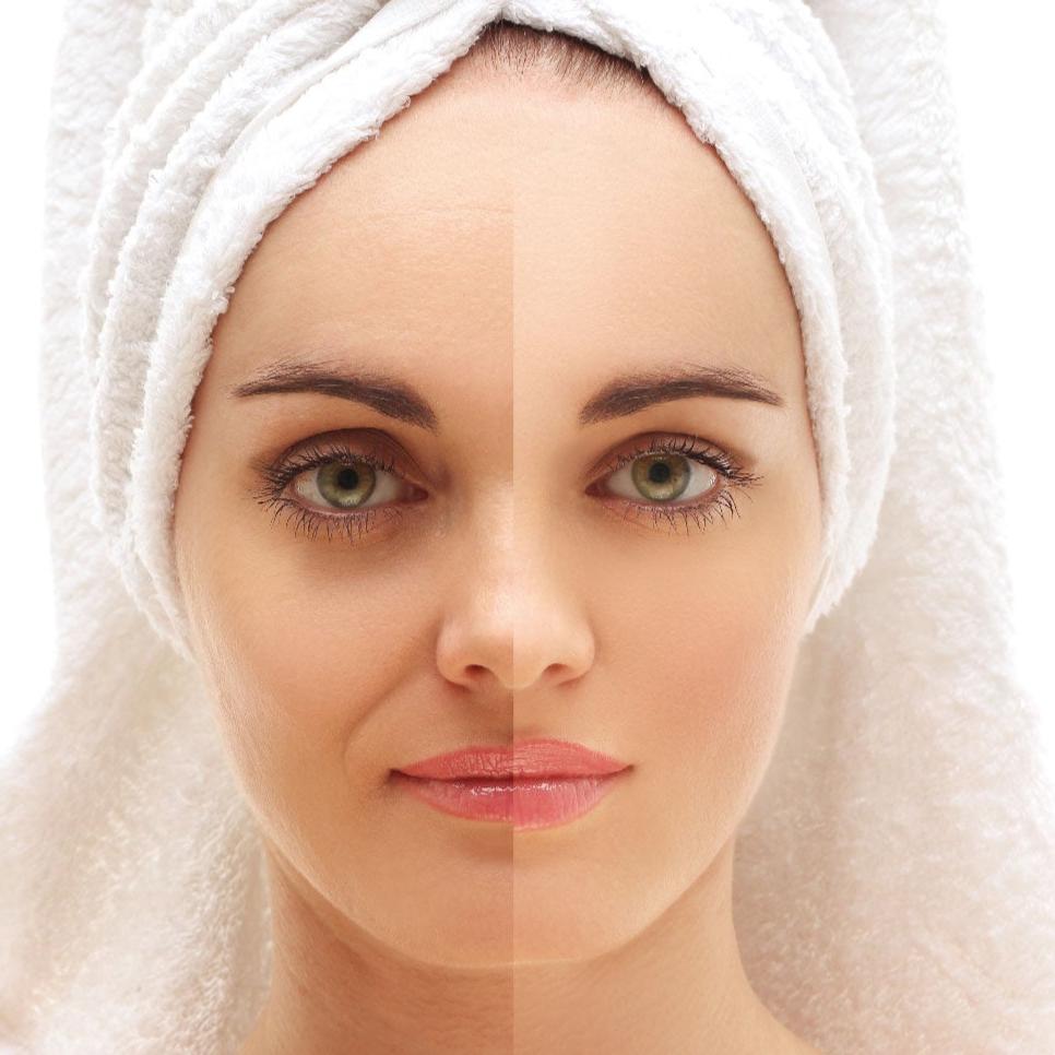 FACELIFT ENERGÉTICO