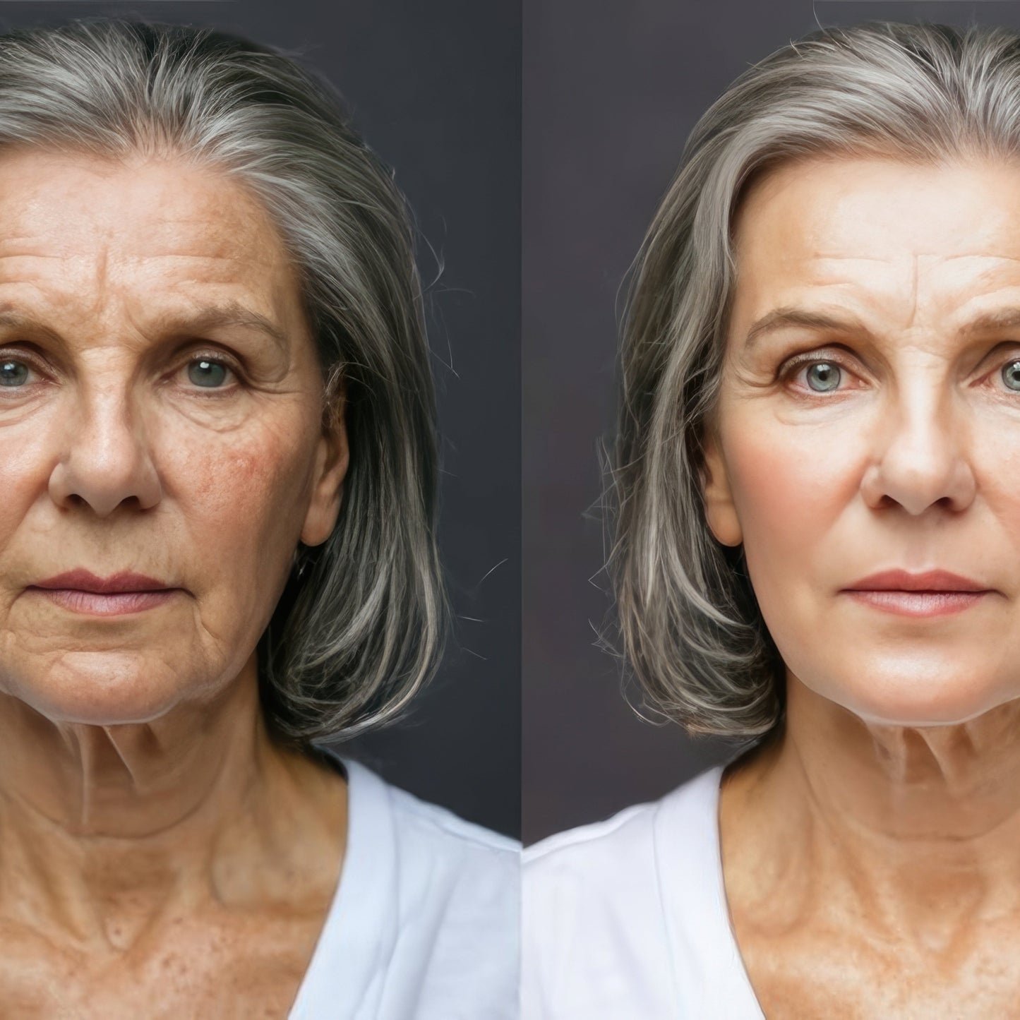 Paquete de 5 Sesiones Facelift Energético